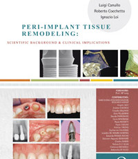 Peri-Implant Tissue Remodeling