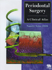 Periodontal Surgery: A Clinical Atlas