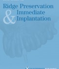 Ridge Preservation and Immediate Implantation