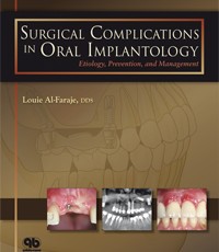Surgical Complications in Oral Implantology: Etiology, Prevention and Management