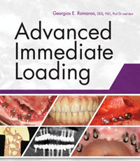 Advanced Immediate Loading