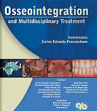 Osseointegration and Multidisciplinary Treatment