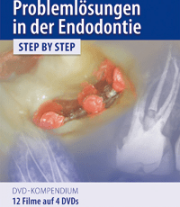Problemlösungen in der Endodontie Step by Step DVD