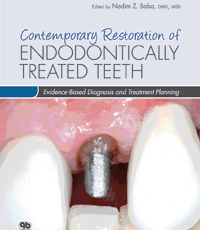 Contemporary Restoration of Endodontically Treated Teeth