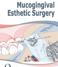 Mucogingival Esthetic Surgery