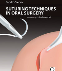 Suturing Techniques in Oral Surgery