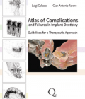 Atlas of Complications and Failures in Implant Dentistry