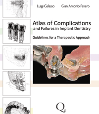 Atlas of Complications and Failures in Implant Dentistry