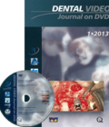 Dental Video Journal DVD 1/2013