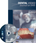 Dental Video Journal DVD 3/2013