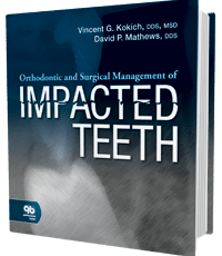 Orthodontic and Surgical Management of Impacted Teeth