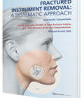 Fractured Instrument Removal DVD