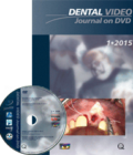 Dental Video Journal 1/2015