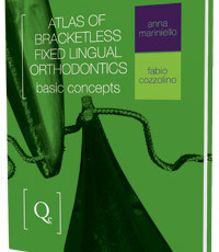 Atlas of Bracketless Fixed Lingual Orthodontics: Basic Concepts