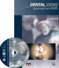 Dental Video Journal 2/2015