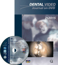 Dental Video Journal 2/2015