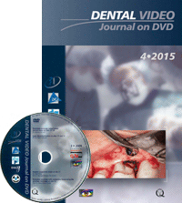 Dental Video Journal 4/2015
