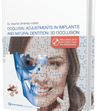 Occlusal Adjustments in Implants and Natural Dentition: 3D Occlusion