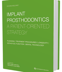 Implant Prosthodontics: A Patient-Oriented Strategy