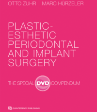 Plastic-Esthetic Periodontal and Implant Surgery, DVD