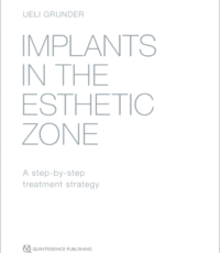 Implants in the Esthetic Zone: A Step-by-Step Treatment Strategy