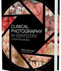 Clinical Photography in Dentistry: A New Perspective