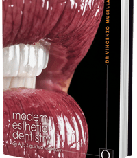 Modern Esthetic Dentistry: An A to Z Guided Workflow