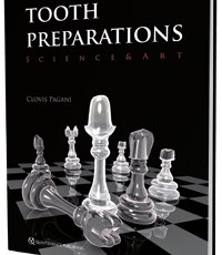 Tooth Preparations: Science & Art
