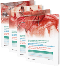 Tabanella: Decision making for retreatment of failures in dental medicine – DVD