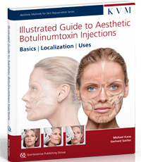 Illustrated Guide to Aesthetic Botulinumtoxin Injections