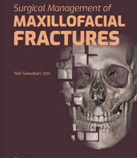 Surgical Management of Maxillofacial Fractures