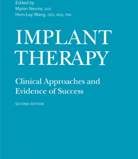Implant Therapy: Clinical Approaches and Evidence of Success