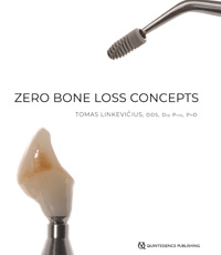 Zero Bone Loss Concepts