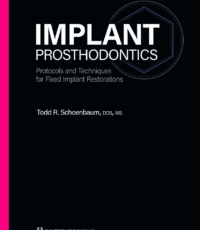 Implant Prosthodontics: Protocols and Techniques for Fixed Implant Restorations