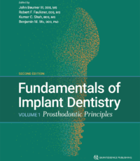 Fundamentals of Implant Dentistry, Volume 1: Prosthodontic Principles