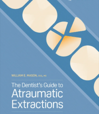The Dentist’s Guide to Atraumatic Extractions