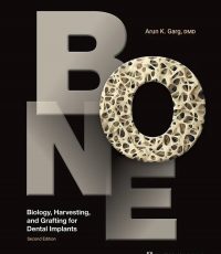 BONE: Biology, Harvesting, and Grafting for Dental Implants