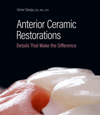 Anterior Ceramic Restorations: Details That Make the Difference