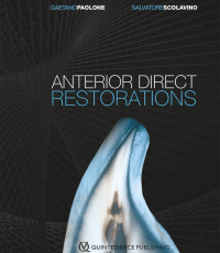 Anterior Direct Restorations