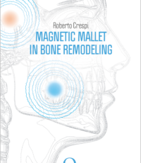 Magnetic mallet in bone remodeling