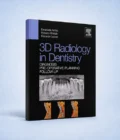 3D Radiology in Dentistry