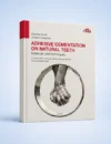 Adhesive cementation on natural teeth