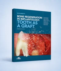 Bone regeneration in implantology: tooth as a graft