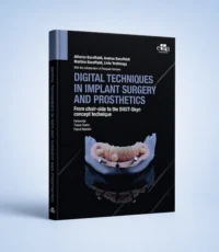 Digital Techniques in Implant Surgery and Prosthetics