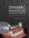 Dynamic Navigation in Implant Dentistry
