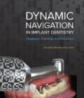 Dynamic Navigation in Implant Dentistry