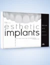 Esthetic Implants