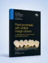 Fixed prosthesis with vertical margin closure
