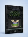 Guided Surgery