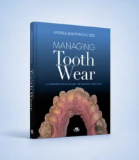 Managing Tooth Wear